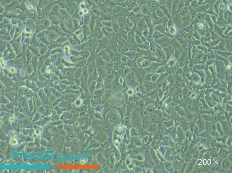 KYSE-450 Cell Complete Medium - small - 6