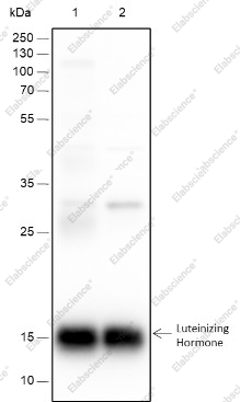 Recombinant Luteinizing Hormone beta Monoclonal Antibody - 1