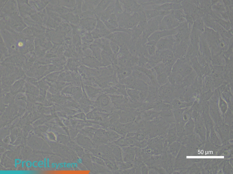 Rat Aortic Adventitial FibroblastsRat Aortic Adventitial Fibroblasts - 4
