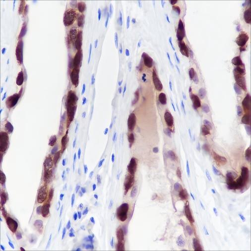 Recombinant CTAG1B Monoclonal Antibody - 2