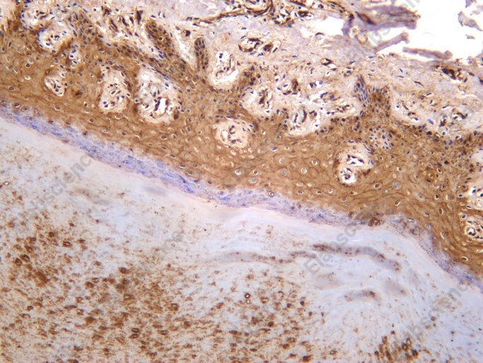 Recombinant FABP5 Monoclonal Antibody - 1