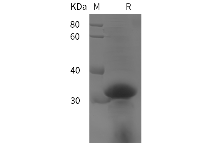 Recombinant Human Collagen alpha-1(I)chain/COL1A1 Protein(TRX,His Tag)-1