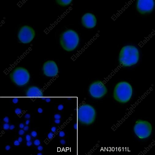 Recombinant NSE Monoclonal Antibody - 3