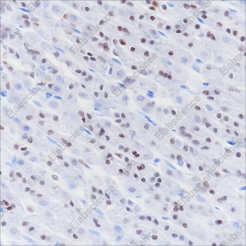 Recombinant SOX2 Monoclonal Antibody - 5