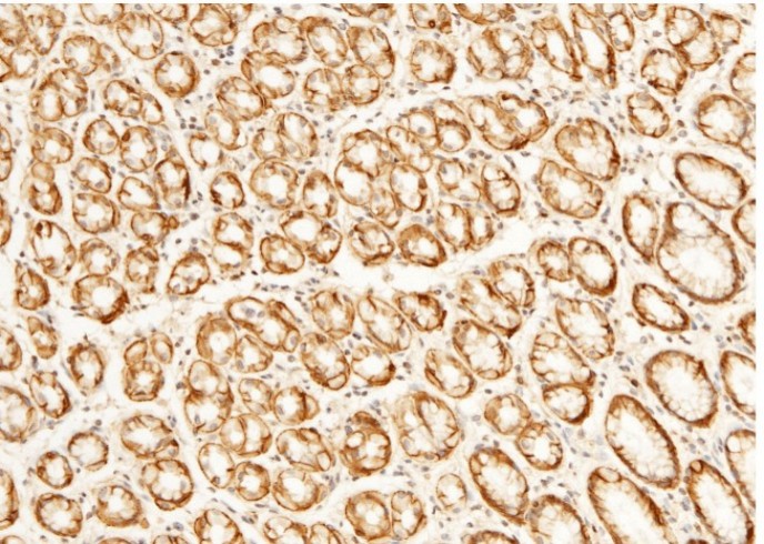Recombinant CD147/EMMPRIN/Basigin Monoclonal Antibody - small - 4