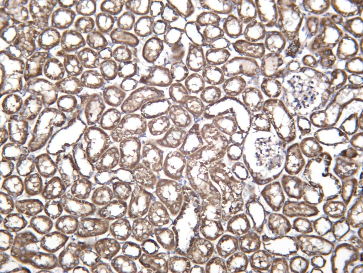 Recombinant ECHA Monoclonal Antibody - 3