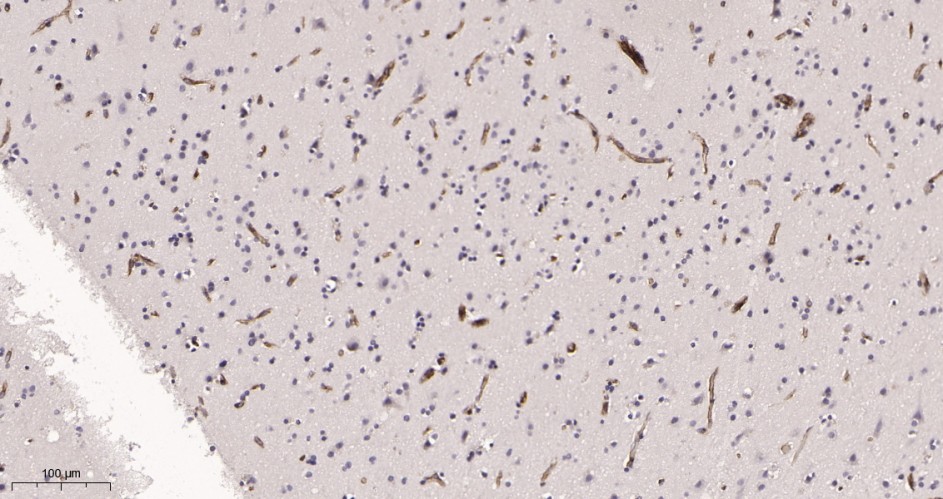 Recombinant IFITM3 Monoclonal Antibody - small - 2