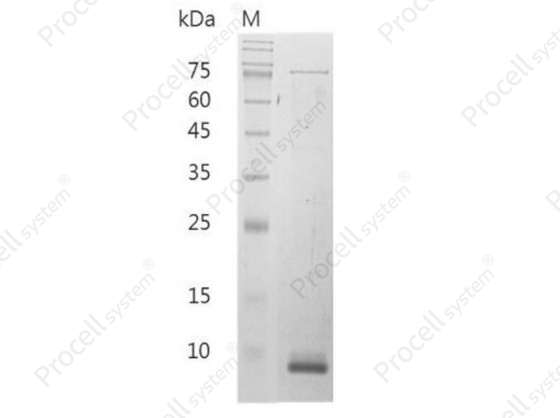 CXCL10/IP-10/Crg-2, Mouse, Recombinant