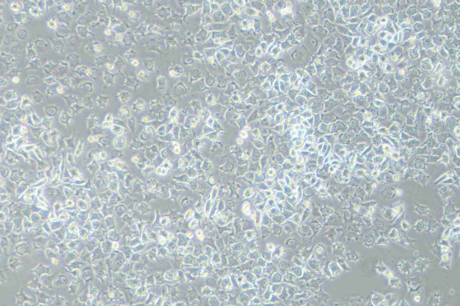 92-1 [Human uveal melanoma] Cell Complete Medium-searchlist-1