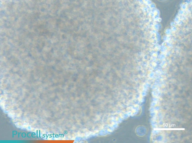 HH [Human lymphoma] - 4