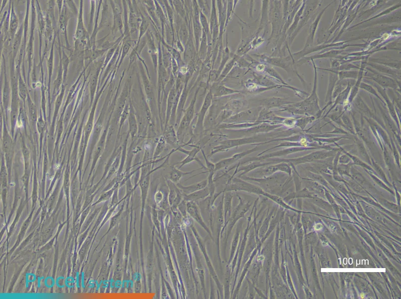 Human Tracheal Fibroblast Complete Medium - 1