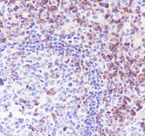 Recombinant CD7 Monoclonal Antibody - small - 3