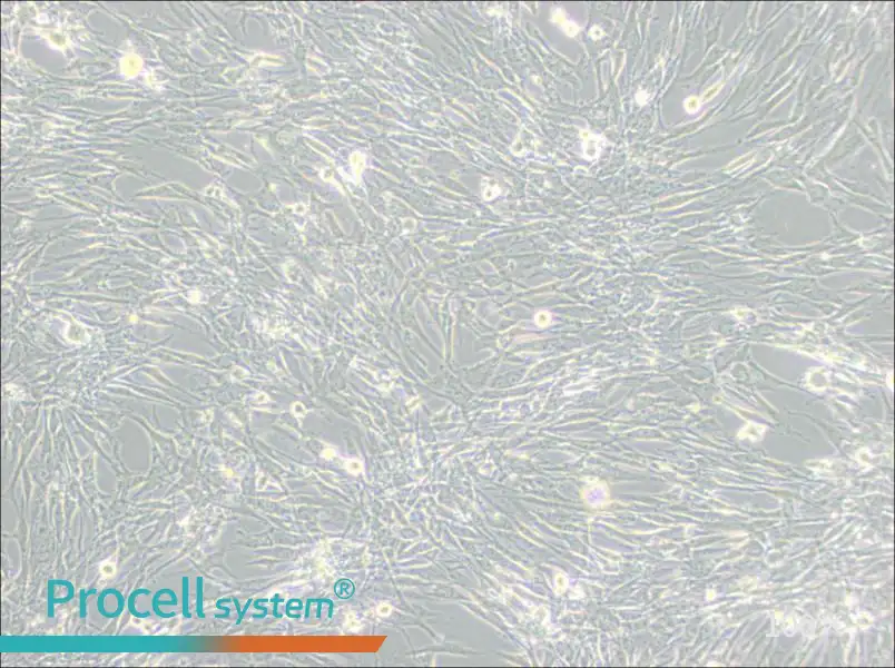 U-118 MG Cell Complete Medium - 2
