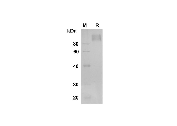 Recombinant Mouse Fas/TNFRSF6/CD95 Protein(His Tag)-产品推荐-1