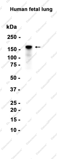 Recombinant Factor H Monoclonal Antibody - 1