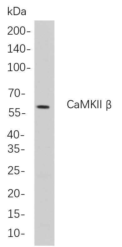 Recombinant CaMKII β Monoclonal Antibody-searchlist-1