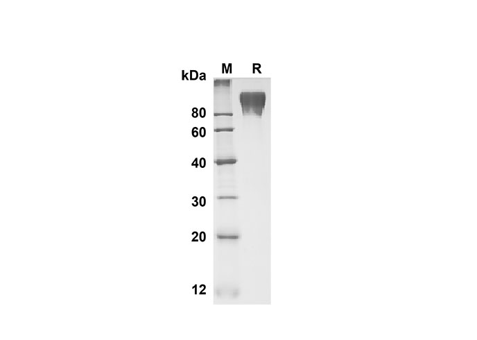 Recombinant Human IL18 Protein(Avi,His Tag)-产品推荐-1