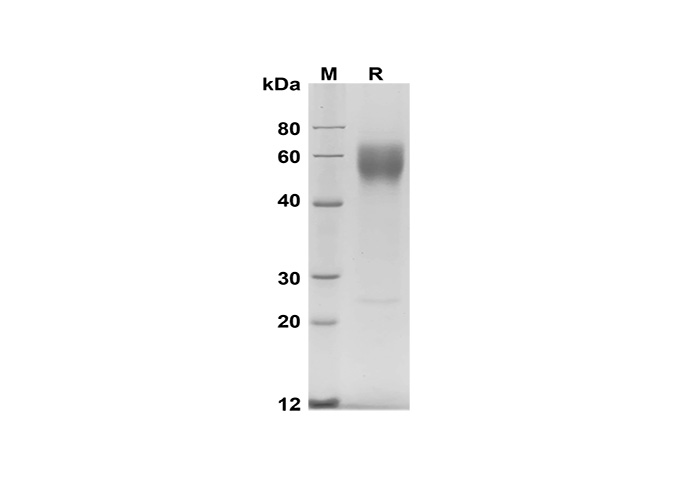 Recombinant Human GP4/CD36 Protein(His Tag)-产品推荐-1