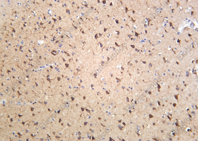 Recombinant Sortilin Monoclonal Antibody - 1