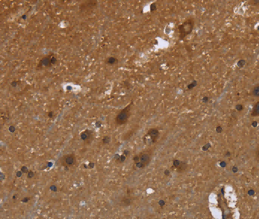 FRK Polyclonal Antibody - 3