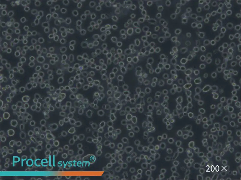 Karpas-299 Cell Complete Medium - 6