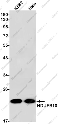 Recombinant NDUFB10 Monoclonal Antibody - 1