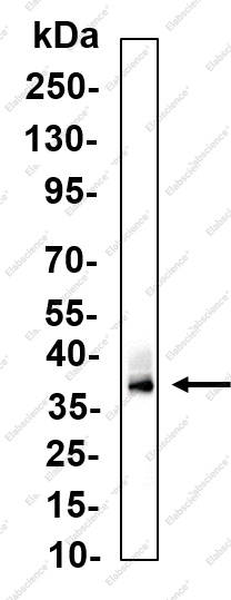 Recombinant LAT Monoclonal Antibody - 1