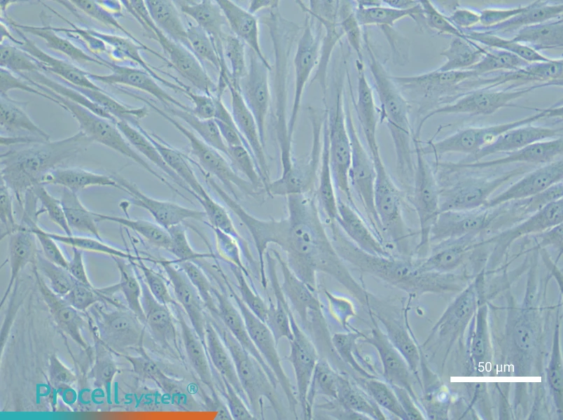 Human Coronary Artery Smooth Muscle Cell Complete Medium - 5