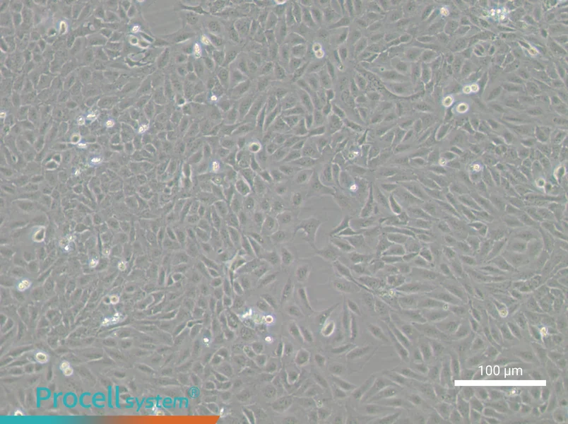 U-2 OS-GFP - 1