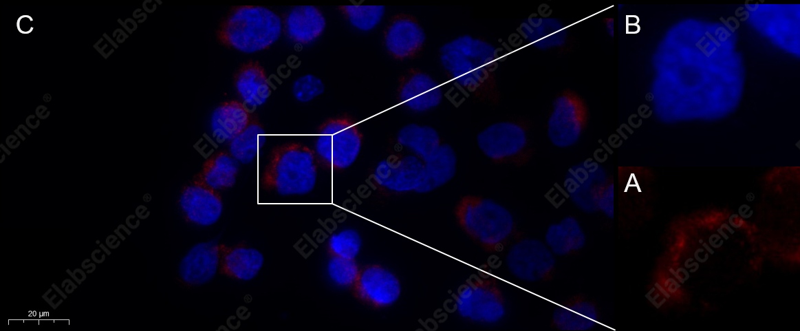 Recombinant ErbB3/HER3 Monoclonal Antibody - 2