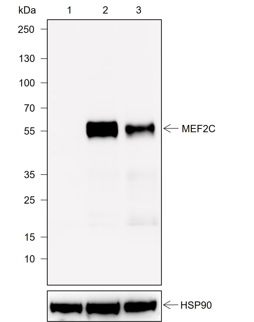 Recombinant MEF2C Monoclonal Antibody-searchlist-1