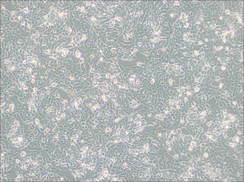NCI-H295R Cell Complete MediumNCI-H295R Cell Complete Medium - 2