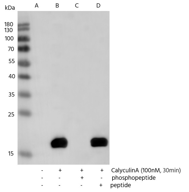 Recombinant Phospho-Myosin Light Chain 2 (Thr18, Ser19) Monoclonal Antibody - small - 2