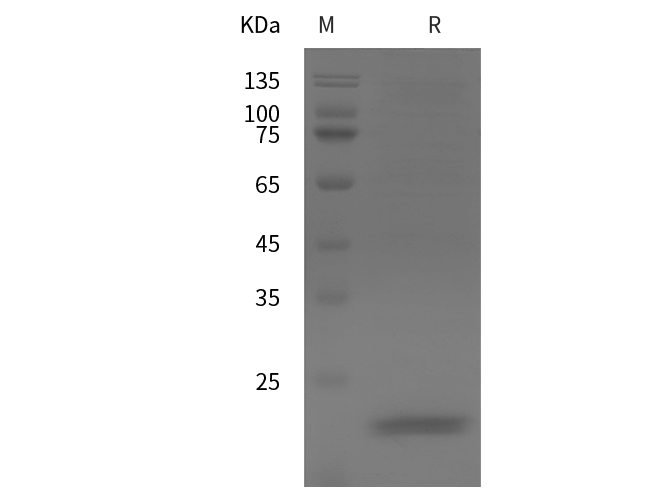 Recombinant Rat IL-17A Protein(Trx Tag)-产品推荐-1