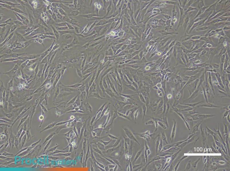 Rat Trabecular Meshwork CellsRat Trabecular Meshwork Cells - 2
