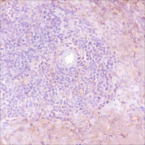 Recombinant VPAC2 Monoclonal Antibody - small - 3
