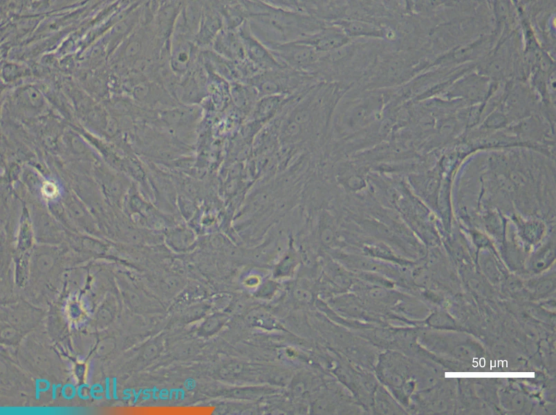 Rat Retinal Muller Cell Complete Medium - 6