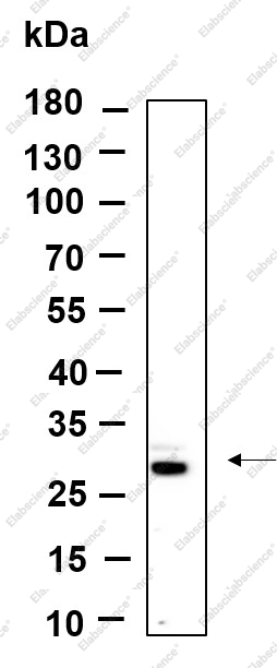 Recombinant FRAT1 Monoclonal Antibody - 1