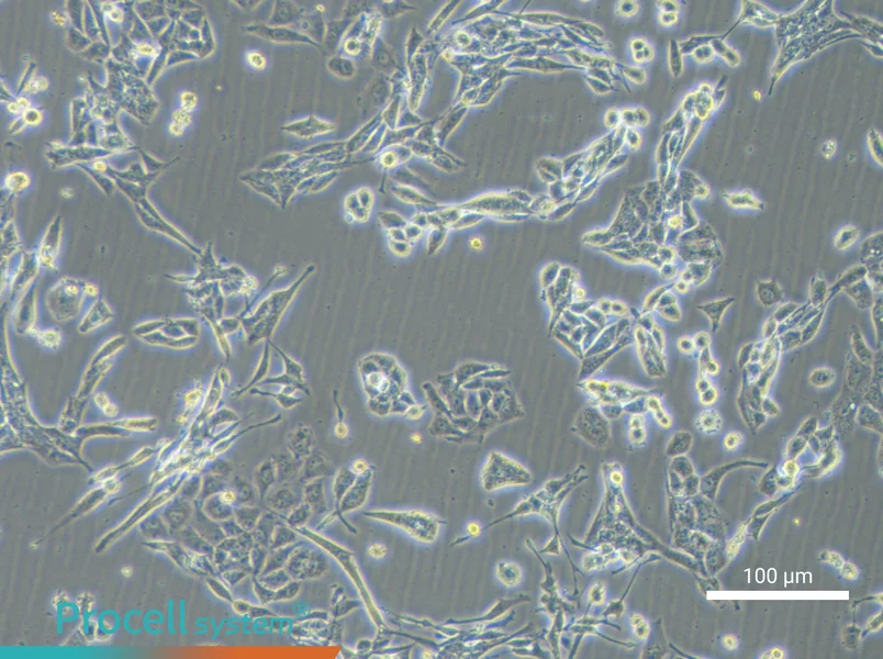 NCI-H446 [H446]NCI-H446 [H446] - 2