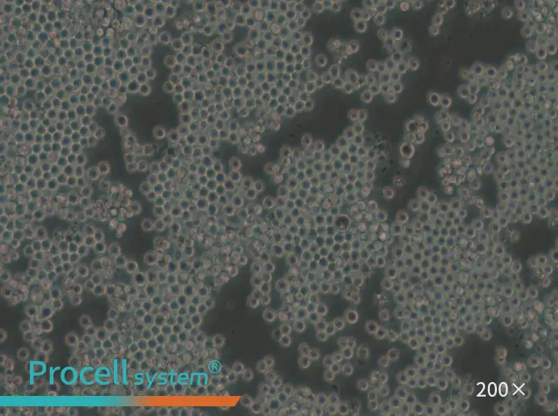 P3/NSI/1-Ag4-1 [NS-1] Cell Complete Medium - small - 4