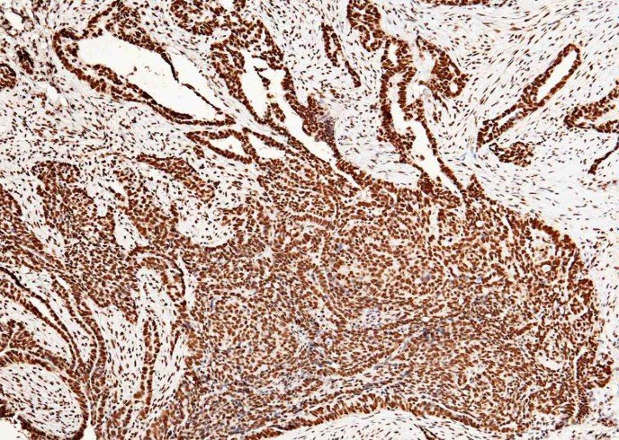 CCNE1/Cyclin-E1 Monoclonal Antibody - small - 2