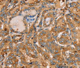 PLS3 Polyclonal Antibody - 2