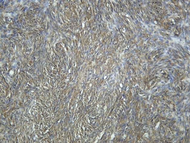 Recombinant CYP19A1 Monoclonal Antibody - 1