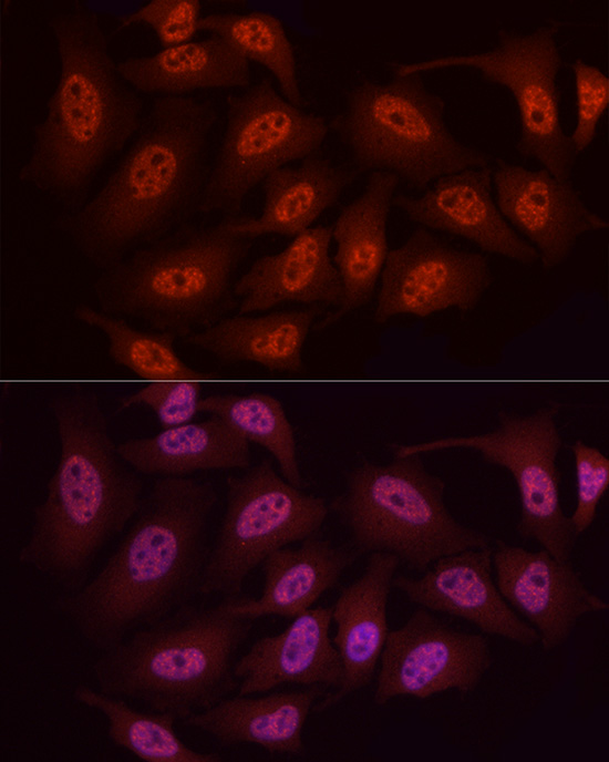 Immunofluorescence analysis of HeLa cells using WTAP Polyclonal Antibody at dilution of 1:50 (40x lens). Blue: DAPI for nuclear staining.