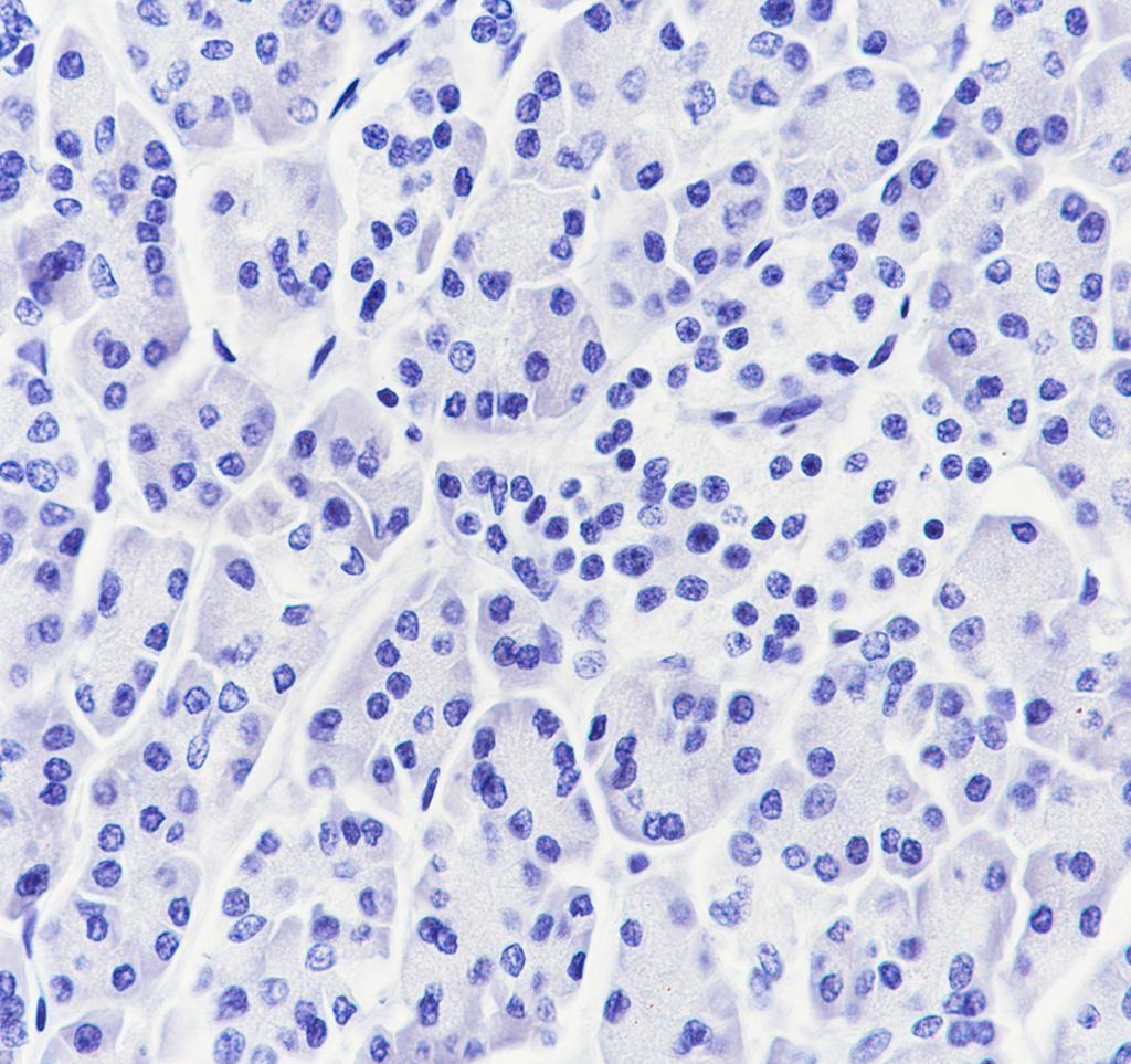 Recombinant CGA/hCG alpha Monoclonal Antibody - small - 4