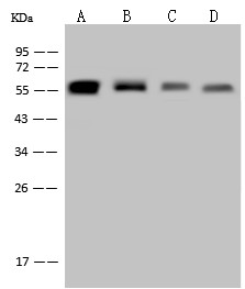 Recombinant Vimentin/VIM Monoclonal Antibody - small - 4