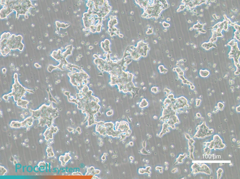NCI-H209 [H209] - 1