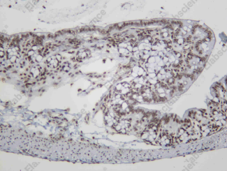 Recombinant HOXB13 Monoclonal Antibody - 1