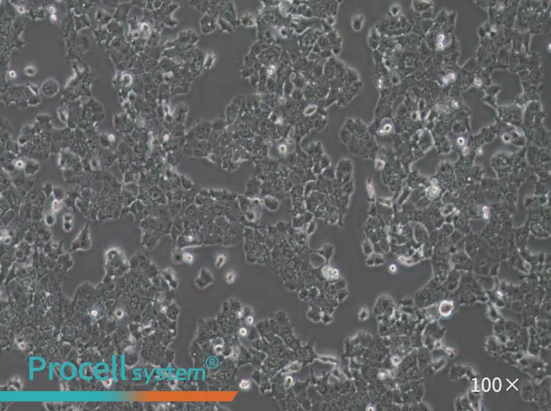 NCI-H1573 Cell Complete Medium - 3