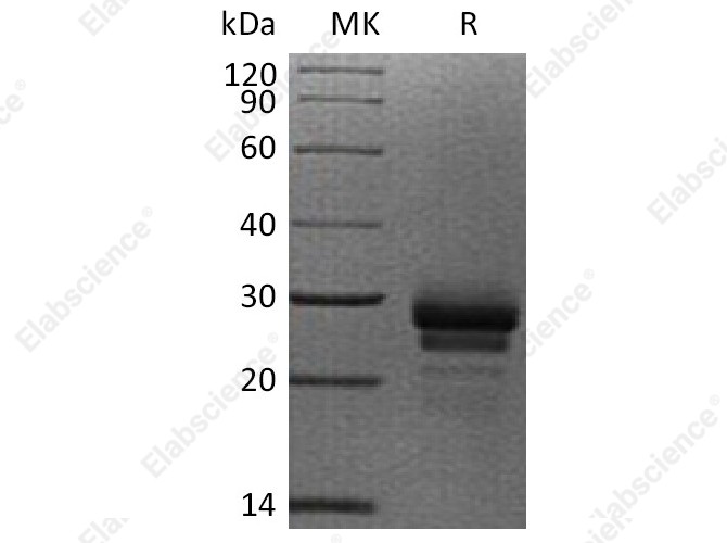 Recombinant Human VEGF-C/VEGFC Protein (His Tag) - 1